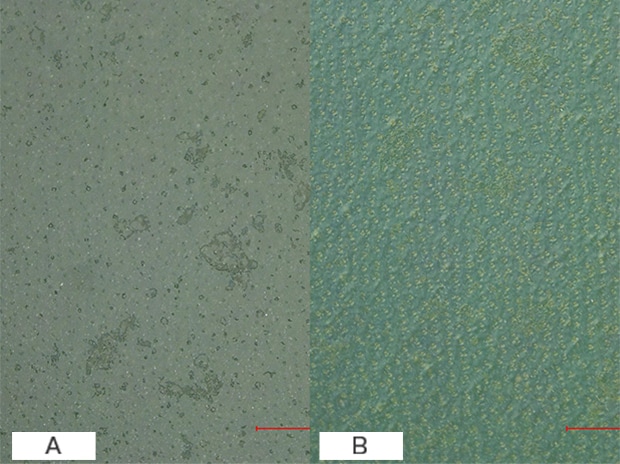 Observation And Measurement Of Coating Using A Digital Microscope ...