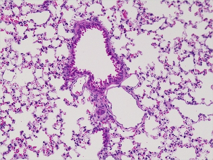 Image: Normal mouse lung (stained with H&E)...