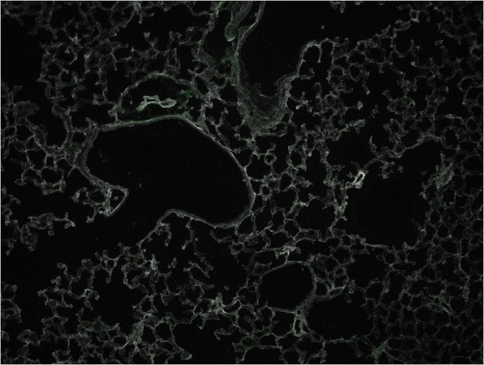 Image: Normal lung stained with immunofluorescence...