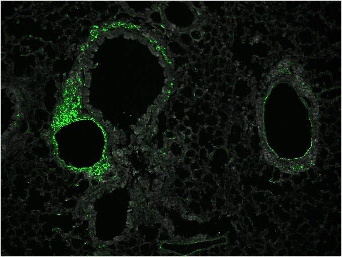 Image: Lung with asthma symptoms stained with immunofluorescence...