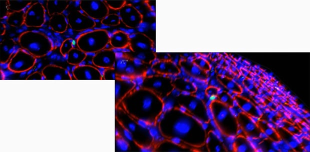 Example of the observation of the 3D structure of muscle fiber