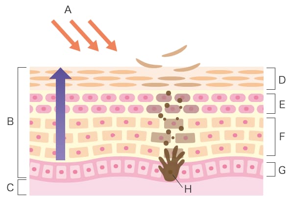 Quantitative Analysis of Skin Damage Caused by Ultraviolet Radiation ...